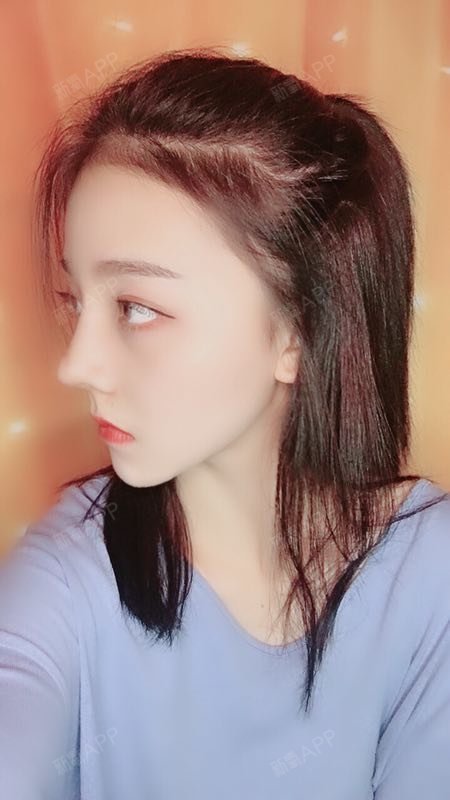 再来分享一波照片,弧度自然,侧面鼻子特别翘,鼻小柱_圈子-新氧美容