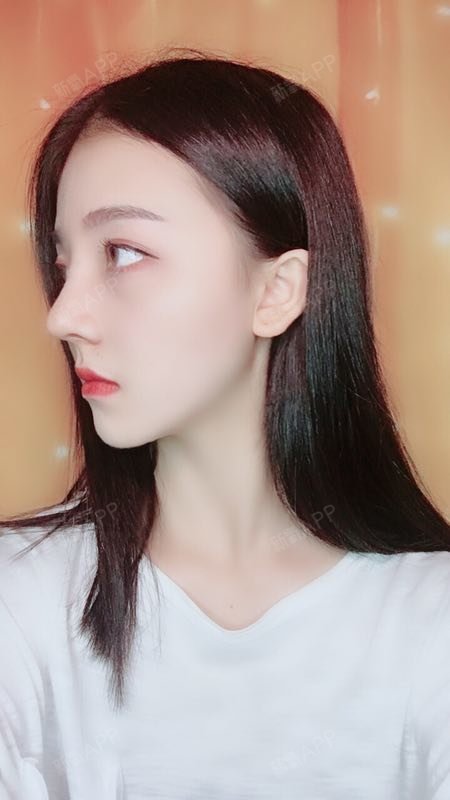 鼻部 | 术后当自强 | 成都同城 | 鼻部综合 | 鼻综合 | 隆鼻术后