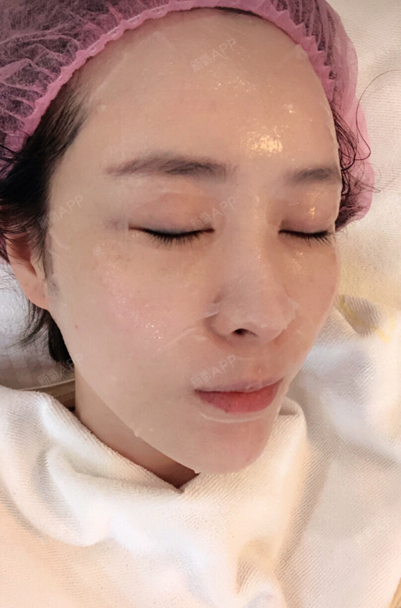 上海无针水光好不好_效果图_独爱小丫头无针水光术后第3天_新氧美容