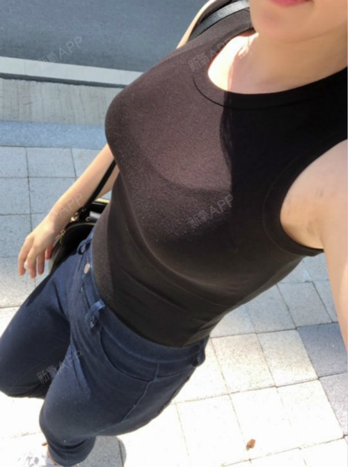 手术院长;宋升彧假体大小:275cc切口部位;胸下_圈子-新氧美容整形