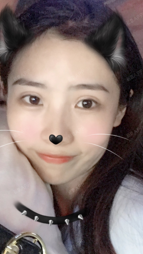 埋线双眼皮