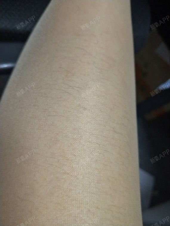 我的腿毛多到,穿丝袜的时候可以把腿毛一根根看的很清_圈子-新氧美容