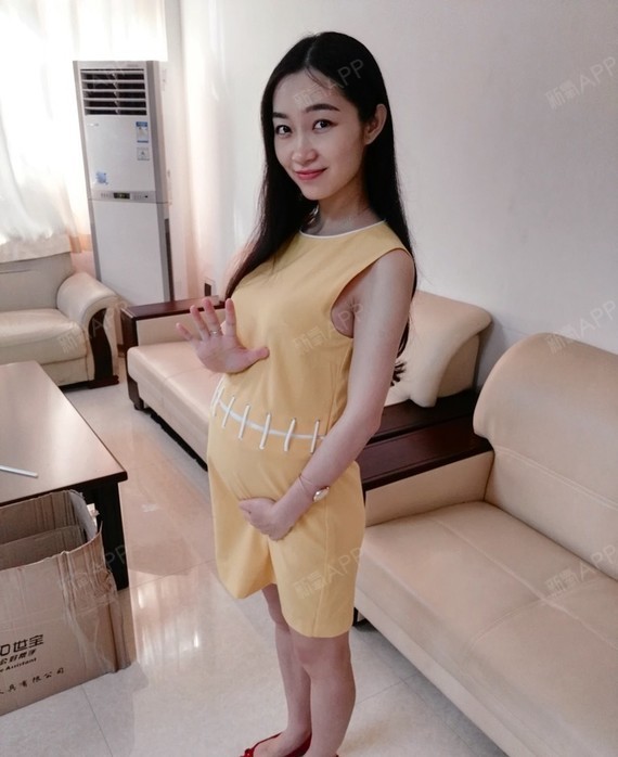 手术紧缩阴道好不好_效果图_氧气tyzc5c4手术紧缩阴道术后第184天