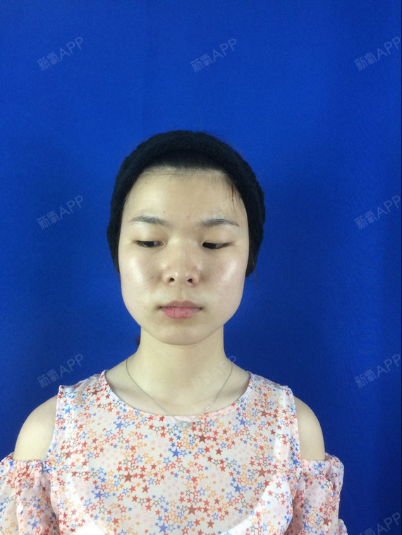 说句实话我觉得自己长的真的挺一般的,一张方正国字脸_圈子-新氧美容