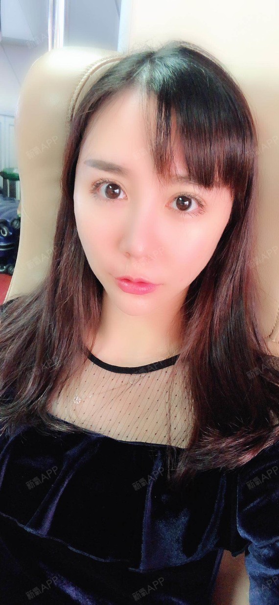 白如玉自体脂肪全脸填充第321天美丽日记