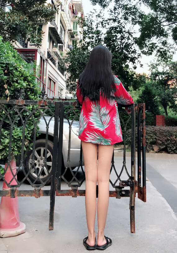 衡阳吸脂瘦大腿好不好_效果图_reserved吸脂瘦大腿术后第30天_新氧