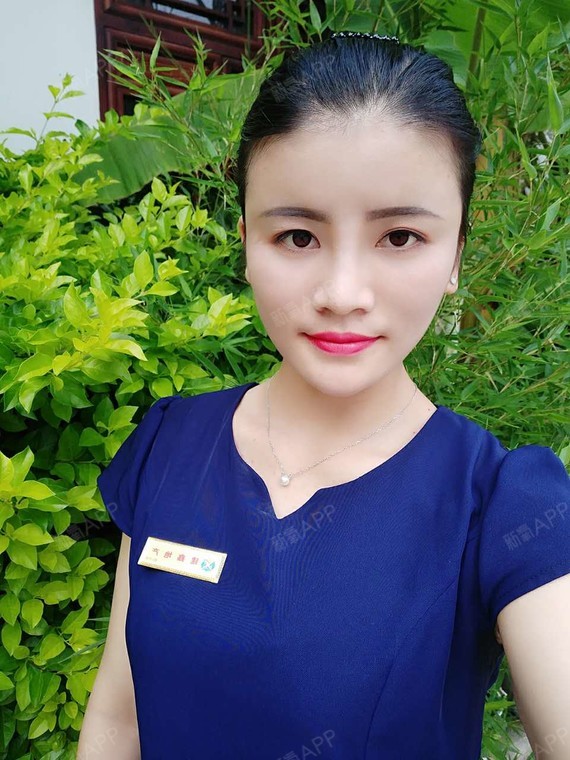 自体脂肪全脸填充好不好_效果图_外有美人皮内有玲珑心自体脂肪全脸