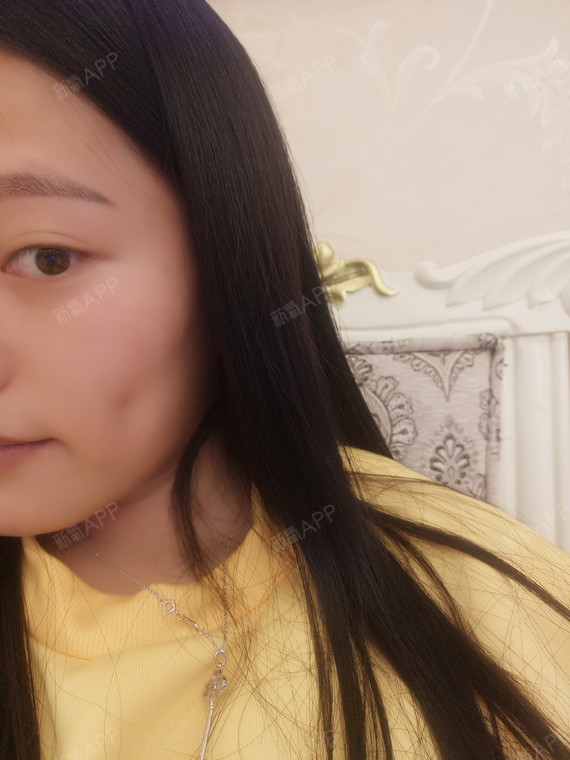 氧气cxo2f34酒窝成形术第5天美丽日记