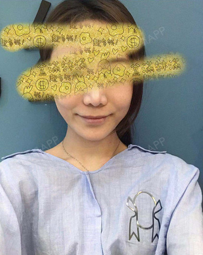 和医生聊了很久终于确定了酒窝形态:长条形的酒窝是我_圈子-新氧美容