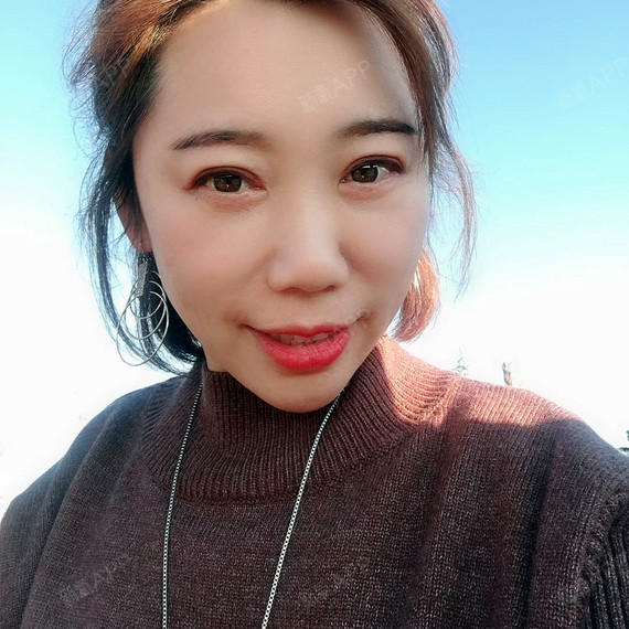 【红颜拜博外切祛眼袋第30天】术后一个月了~我是祛_圈子-新氧美容