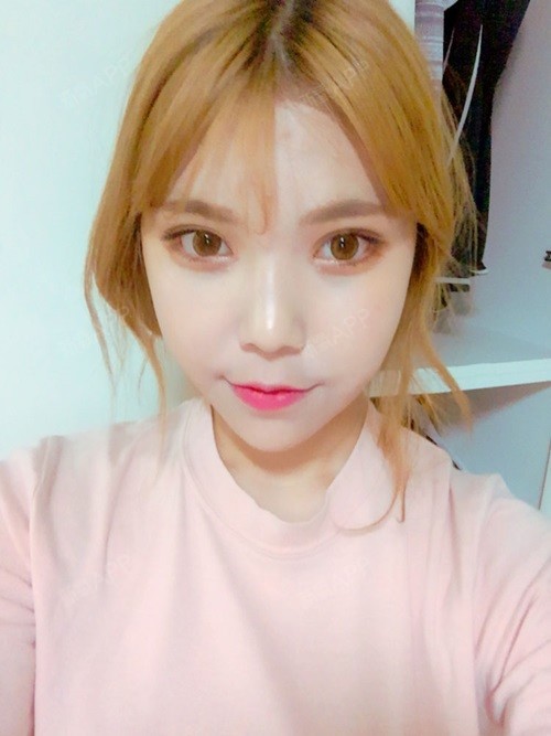 已经两个月了,我要的精致巴掌小脸终于实现了,现在每_圈子-新氧美容