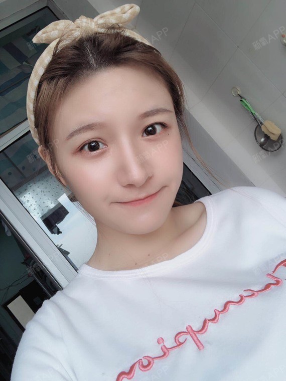 现在下巴已经很自然了,捏_圈子-新氧美容整形