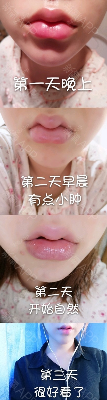 今天是第三天嘻嘻效果还是不错的刚开始的第一天是硬