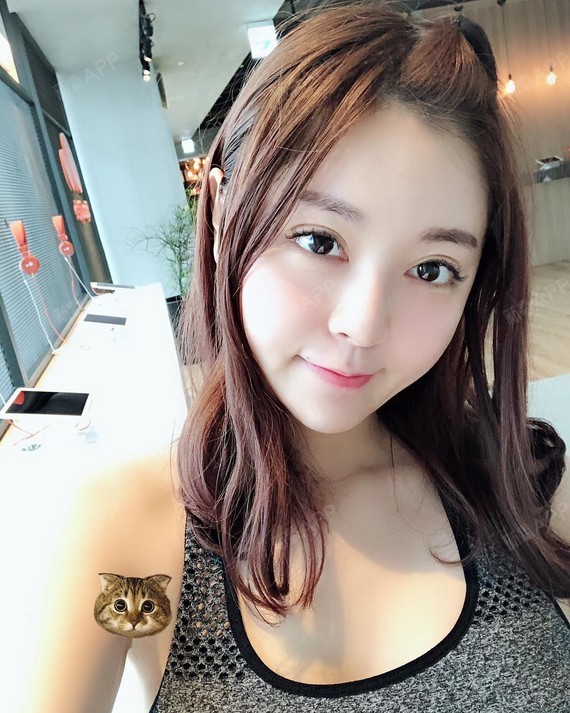 重庆自体脂肪隆胸好不好_效果图_阿狸桃子的纯纯的爱自体脂肪隆胸术后