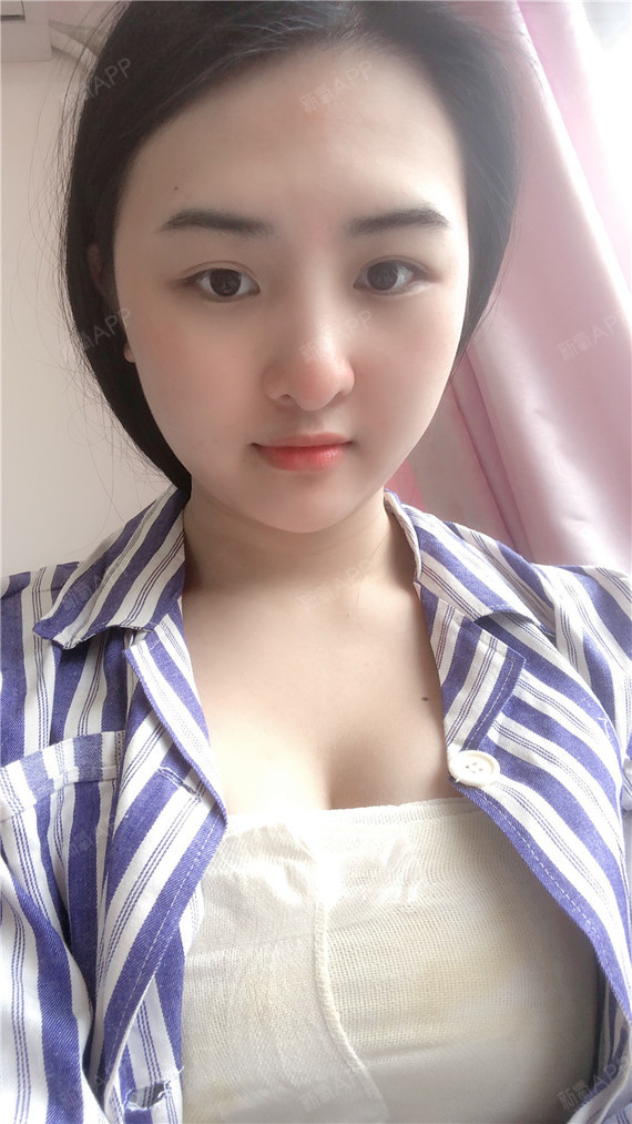 做完丰胸在艺美休息了一晚,跟度假住酒店的感觉太相像_圈子-新氧美容