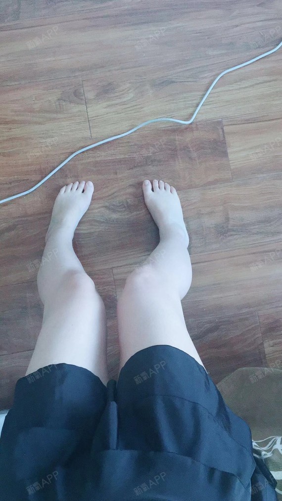好久没有更新照片的啦,因为腿部也没有啥问题,都要快_圈子-新氧美容