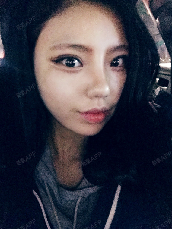 影子追着光梦游鼻综合第45天美丽日记-新氧美