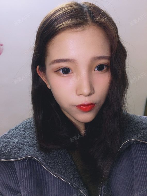 veee偏爱你自体脂肪全脸填充第355天美丽日记