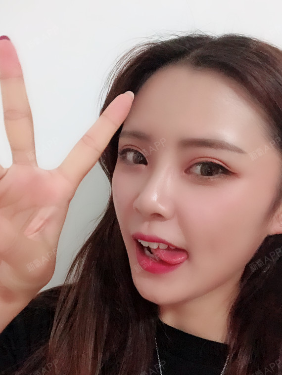 小圆子圆圆圆切开双眼皮第153天美丽日记