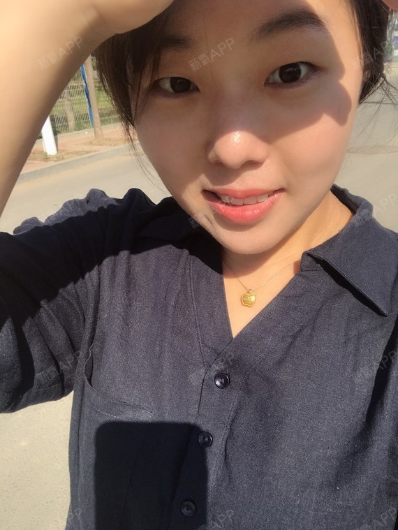 【青岛伊美尔5s重睑术含提肌 超微创开眼角术后59_圈子-新氧美容整形