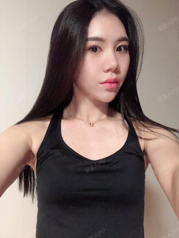 假体隆胸好不好_效果图_温柔霸气范假体隆胸术后第113天_新氧美容整形