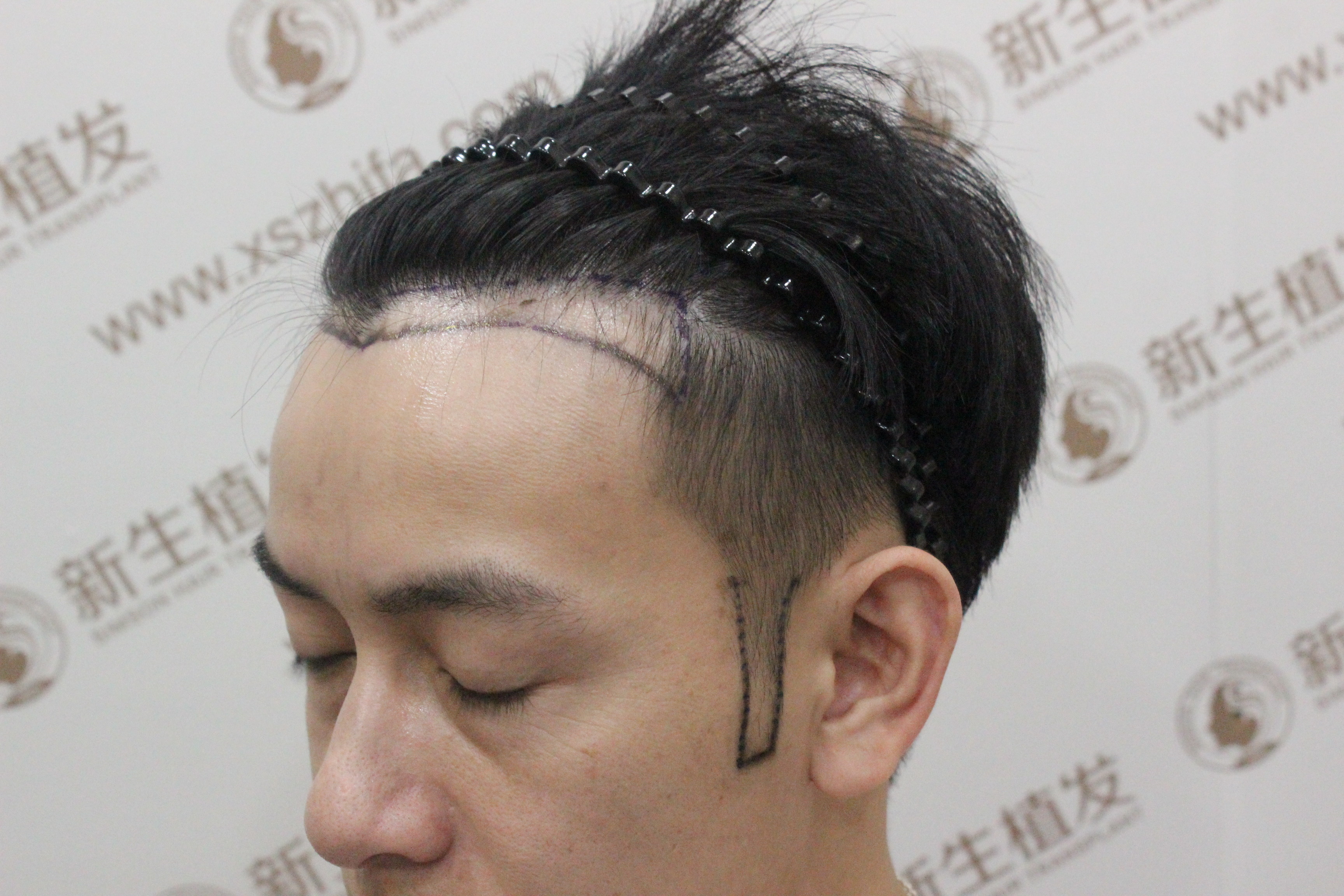 男人“M字”发际线别乱剪发型，注意3个技巧，轻松打造帅气发型_头发