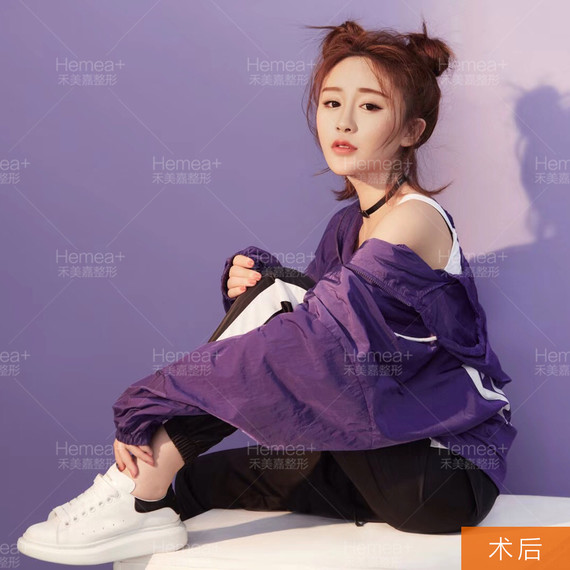面部微雕一次能维持多久_面部精雕_面部微雕是怎么做的