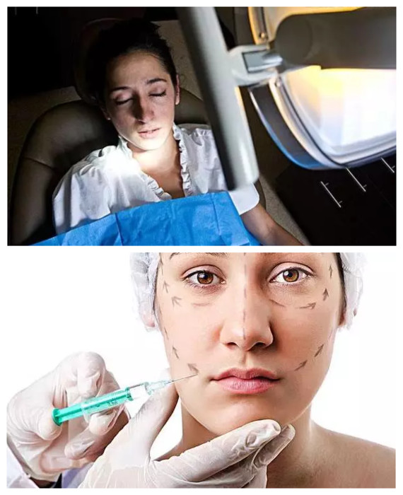 麻醉会不会导致人变笨?