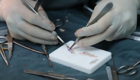 周顺波医生正在术中雕刻肋软骨