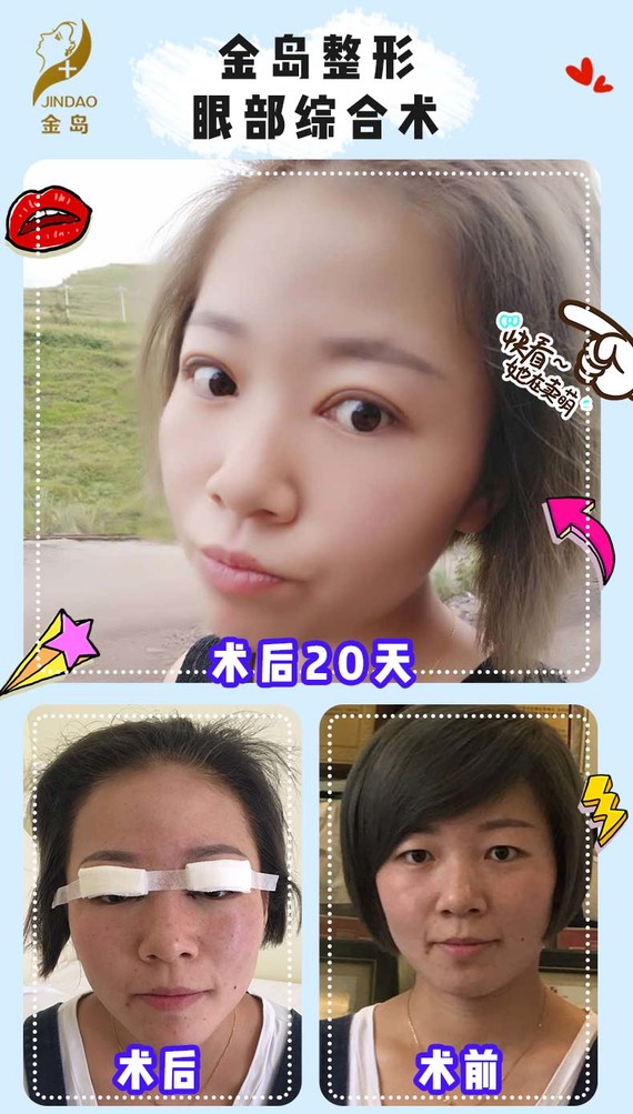 新氧- 徐健 | 青岛同城