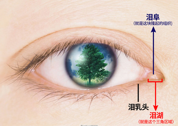 所以我们要具体来说开内眼角需要参考的几个结构特征      泪阜