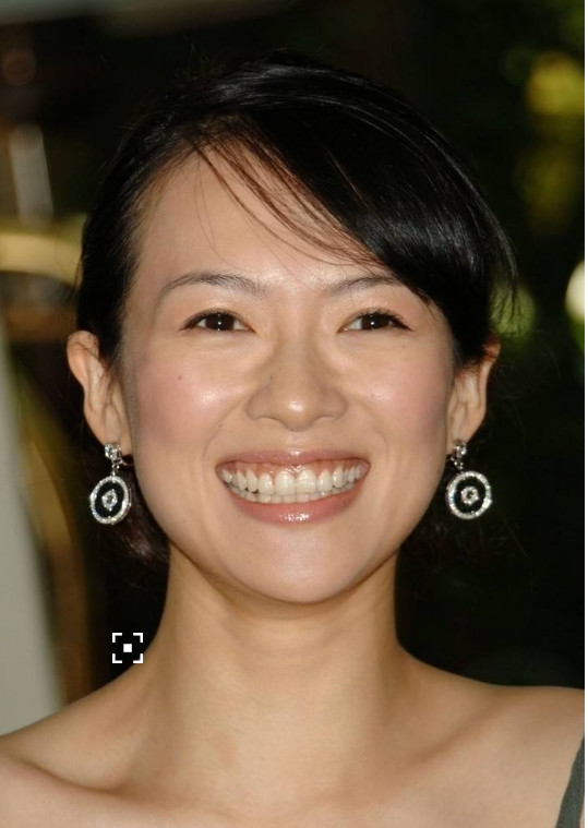 "回眸一笑百媚生",这很大程度上得看牙,如果是一口大黄牙,这笑容可就