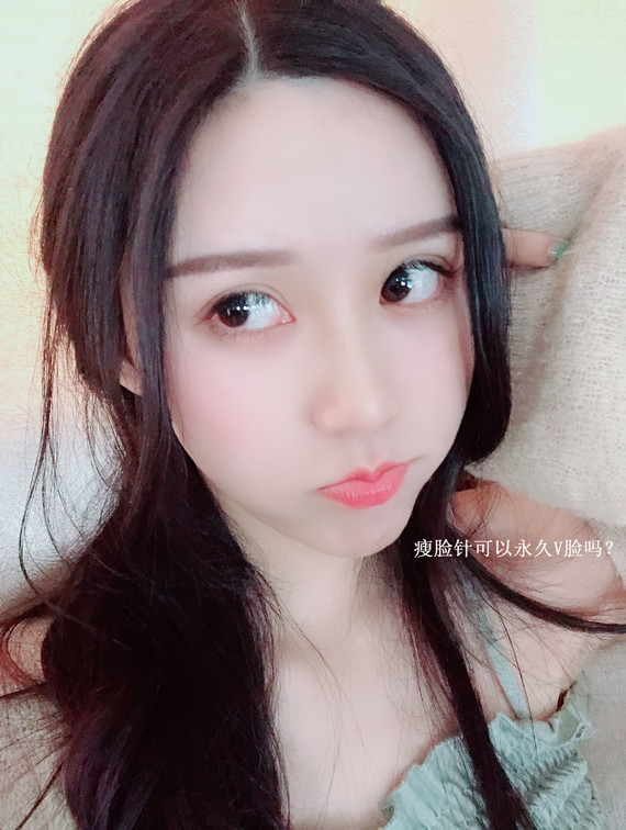 瘦脸针打几次能永久定型?说到美女,首先想到的