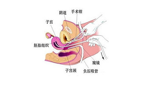 事情,他关联着卵巢,肾脏,脾脏等等脏器相互协调的日程发生巨大的变化