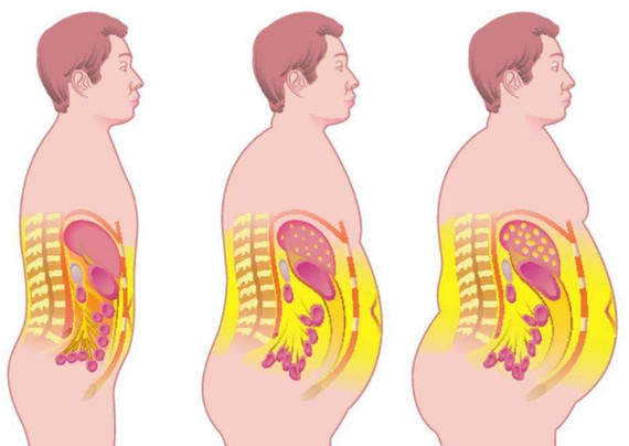 我们先来看看肥胖是如何造成的?