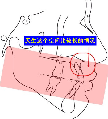 大家都來笑一個 :)