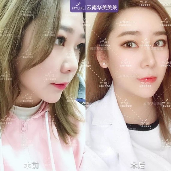 优品聚献·超级新品周|美莱整形专场单品zui高