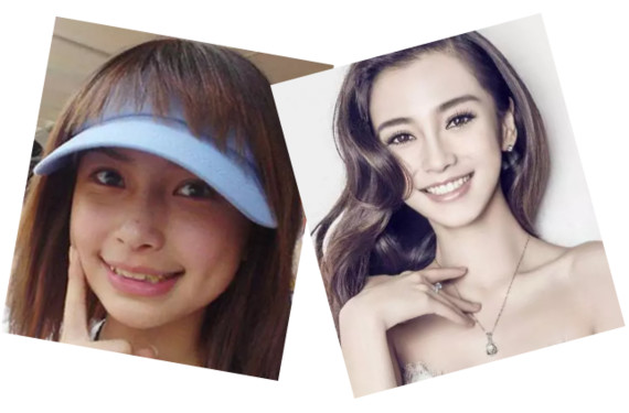 baby的牙齿其实长得非常失败.基因不够,牙医来救!