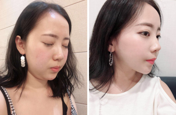 不看对比照就不信的宝宝们,再往下看!