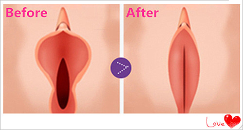 韩国da整形医院-【私密整形】