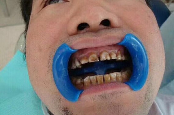 改变后,大哥笑的嘴都合不拢他说没想到