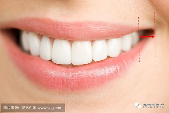 (双向箭头区域即"颊廊")"牙弓"是指牙齿沿着牙槽骨在牙床上依次排列成