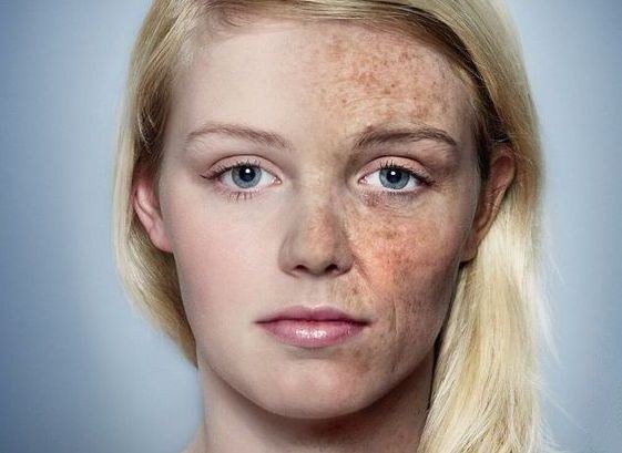 女性如何延缓衰老?