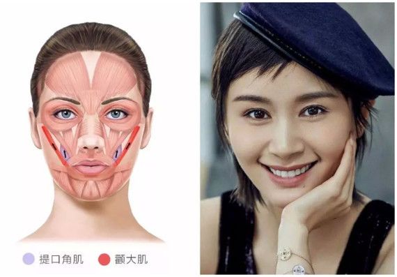 想给笑容加分?这些项目了解一下 酒窝形成手术