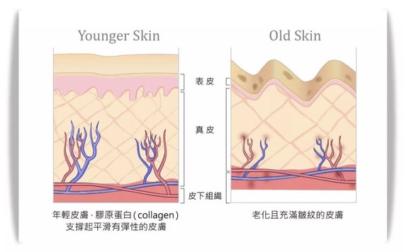 皮肤内弹性纤维断裂图图片