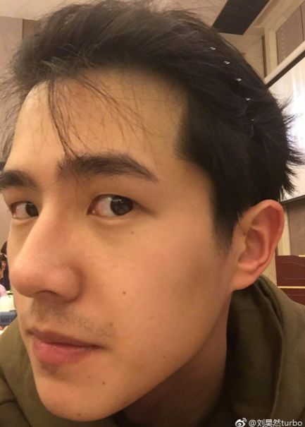 鼻额角的过度也非常自然,直接提高了整张脸的精致度.