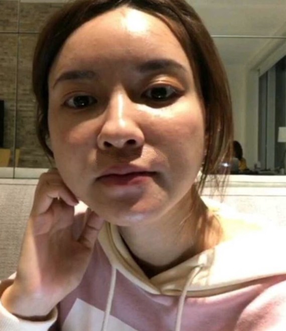 文章转自美少女挖掘机(meishaonv023),_圈子-新氧美容整形