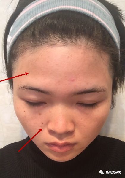 may的眉弓较高,但额头与眉骨之间过渡区域凹陷; 太阳穴部位也不够