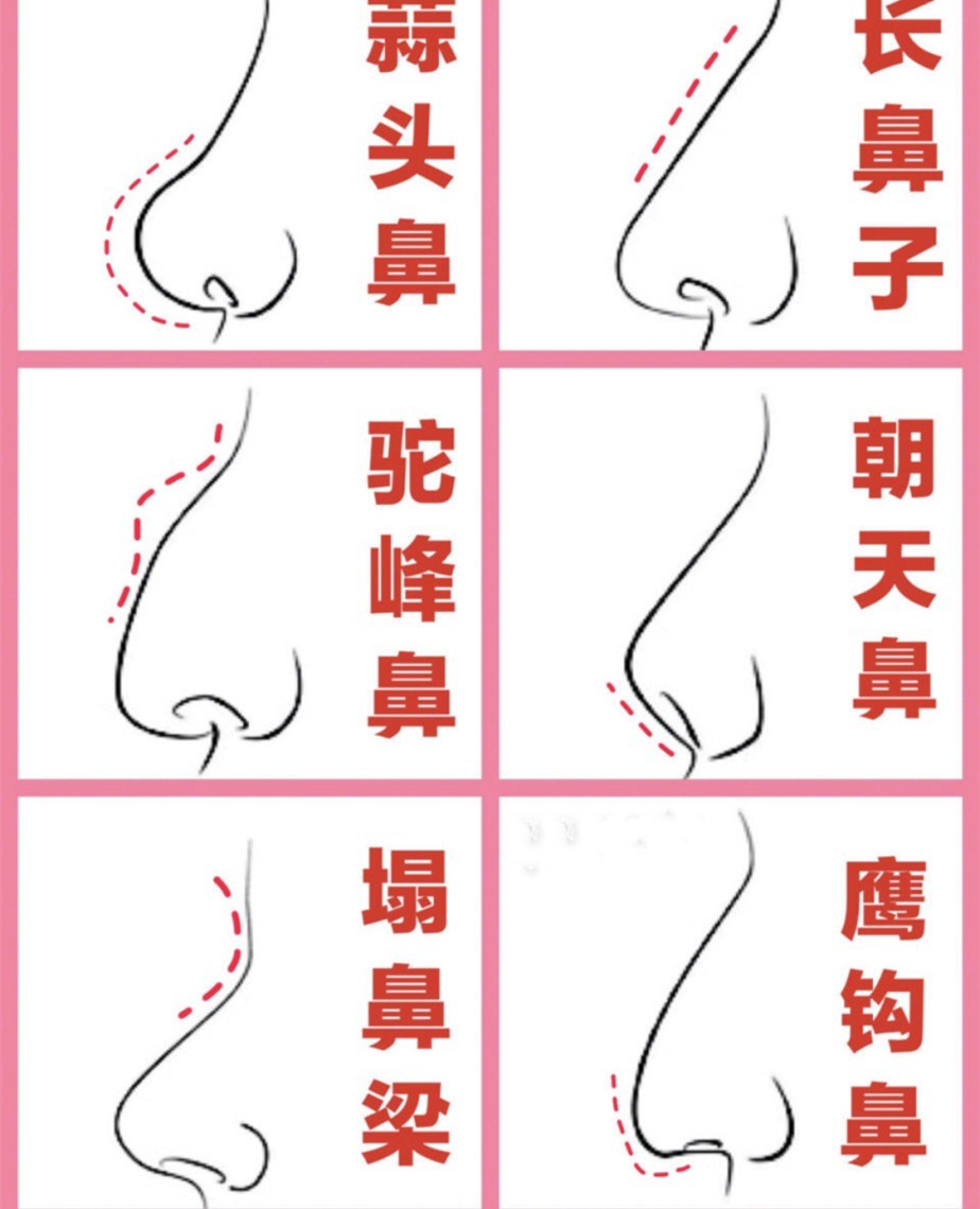 女人十种鼻型分类图图片