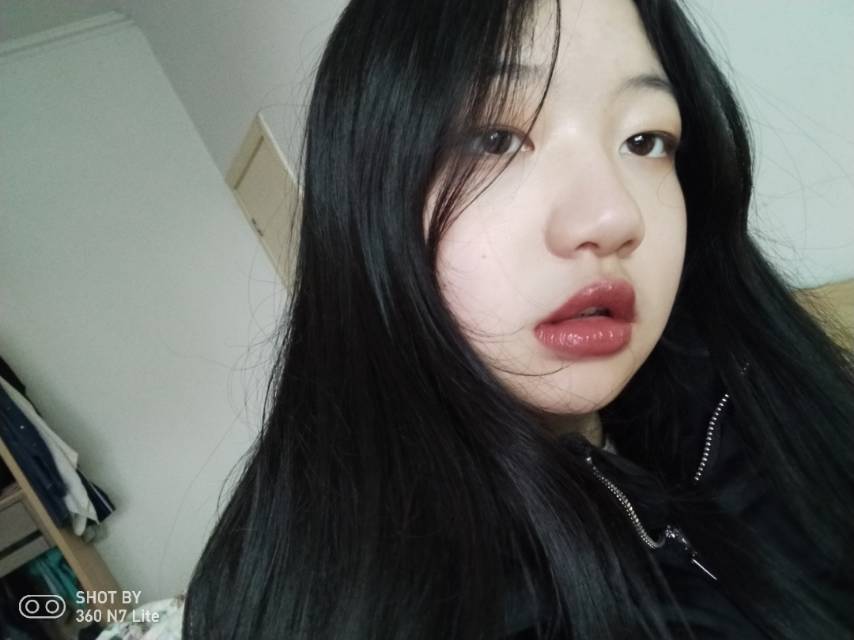 前面两个牙齿有一点突出,但是我有点三角嘴,所以还是_圈子-新氧美容